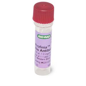 6200203 | His Antibody