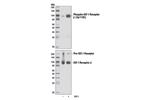 12004S | PhosphoPlus ® IGF-I Receptor beta Antibody Duet