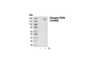 12185S | PhosphoPlus® PERK (Thr980) Antibody Duet