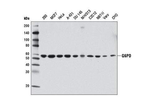 12263S | G6PD (D5D2) Rabbit mAb