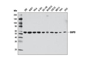 12263S | G6PD (D5D2) Rabbit mAb