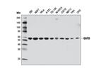 12263S | G6PD (D5D2) Rabbit mAb