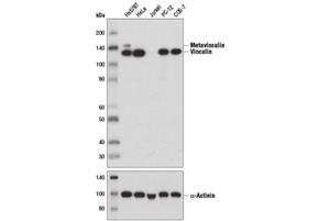 13901S | Vinculin (E1E9V) XPsup>®/sup> Rabbit mAb