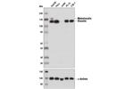13901S | Vinculin (E1E9V) XPsup>®/sup> Rabbit mAb