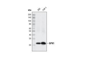 16815T | Redox Homeostasis and Signaling Antibody Sampler Kit