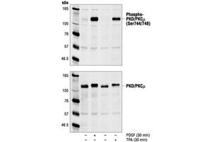 2054L | Phospho-PKD/PKCmu (Ser744/748) Antibody