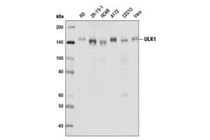 23988S | PhosphoPlus ® ULK1 (Ser757) Antibody Duet