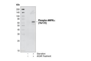 2531L | Phospho-AMPKalpha (Thr172) Antibody