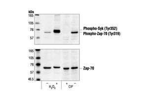 2701L | Phospho-Zap-70 (Tyr319)/Syk (Tyr352) Antibody