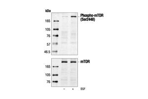 2971S | Phospho-mTOR (Ser2448) Antibody