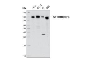 3027L | IGF-I Receptor beta Antibody