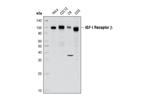 3027L | IGF-I Receptor beta Antibody