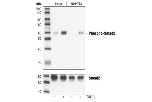 3108L | Phospho-Smad2 (Ser465/467) (138D4) Rabbit mAb