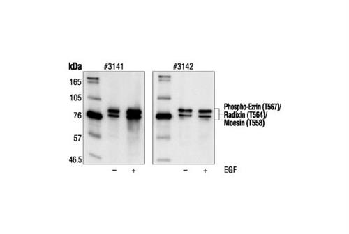 3141L | Phospho-Ezrin (Thr567)/Radixin (Thr564)/Moesin (Thr558) Antibody