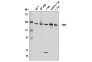 35114T | IFN (Type I/III) Signaling Pathway Antibody Sampler Kit