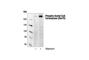 3661L | Phospho-Acetyl-CoA Carboxylase (Ser79) Antibody