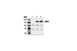 3762S | ASK1 Antibody
