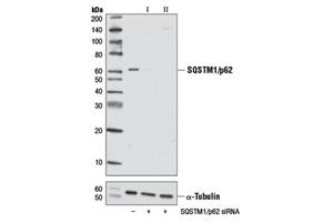 43110T | Mitophagy Antibody Sampler Kit
