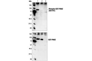 4750T | PAK 1/2/3 Antibody Sampler Kit