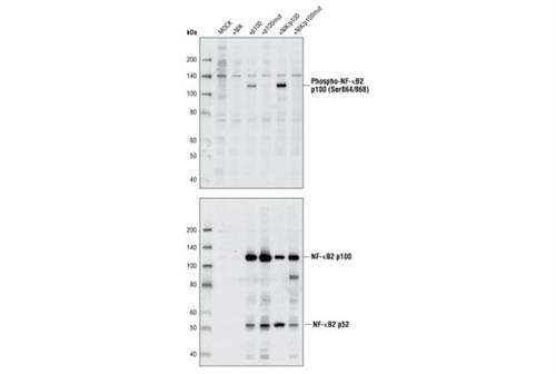 4810L | Phospho-NF-kappaB2 p100 (Ser866/870) Antibody