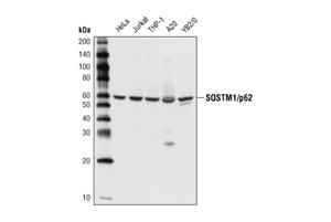 5114S | SQSTM1/p62 Antibody