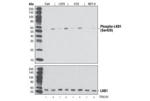 5132S | PhosphoPlus® LKB1 (Ser428) Antibody Duet