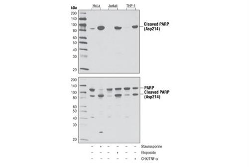 5625T | Cleaved PARP (Asp214) (D64E10) XP ® Rabbit mAb