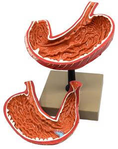 AM0085 | Human Stomach Model, 2 Parts, Three Dimensional, Sectional View with Hand Painted Details - Mounted on Base, 5" x 5" x 7.5" - Eisco Labs