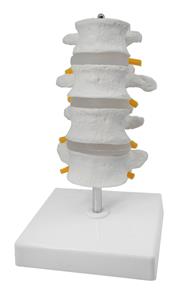 AMCH1054AS | 4 Lumbar Vertebrae with Nerve Branches Model, 7.25" tall - Natural Size - Mounted on Base - Eisco Labs