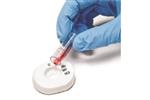 815311005978 | MedMira Miriad Rapid HBc HIV HCV Antibody Test Lab