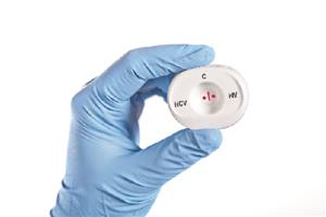 815311006012 | Miriad Rapid HCV HIV Antibody Test Point of Use le