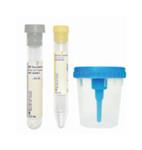 02683193 | Kit Urine Comp 8.0 Coni 50/cs