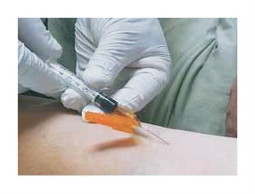 22004242 | Hypo Needle Pro 22x1.5 800/cs