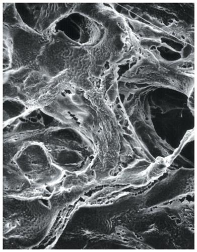 LCWG04700 | MilliporeSigma Mitex Membrane Filters 10 um Gridde