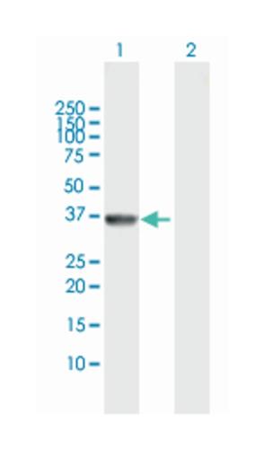 89002918 | Anti-akr7a2 Maxpab 100ul