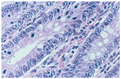 6769008 | Nu-clear I; 3.8 L