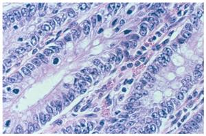 6769008 | Nu-clear I; 3.8 L