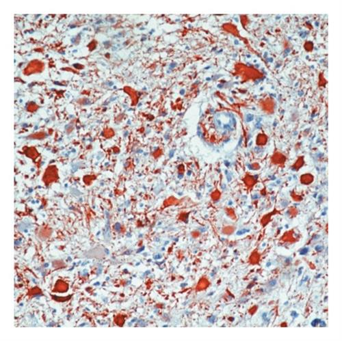 RB087A | GFAP Glial Fibrillary Acidic Protein Host Species