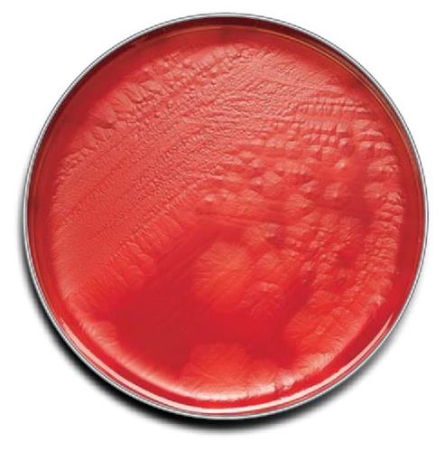 B21734X | Cdc Anaerobe Bld Agr 100/pk
