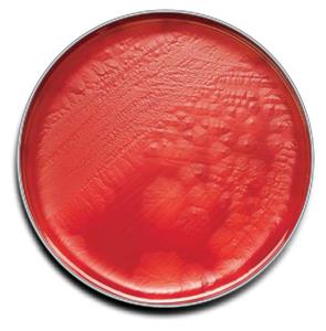 B21734X | Cdc Anaerobe Bld Agr 100/pk