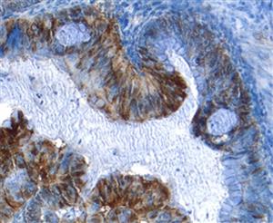 AF1154SP | Hgalectin-3 Aff Pur Pab 25 Ug