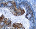 AF1154SP | Hgalectin-3 Aff Pur Pab 25 Ug