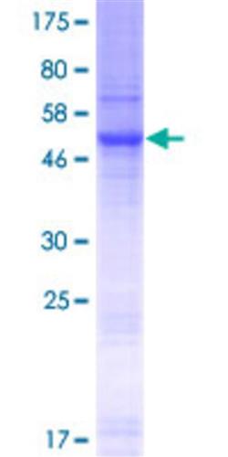 89962302 | Slc35e2 Protein