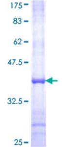 89935180 | Aoc2 (169-268) Protein