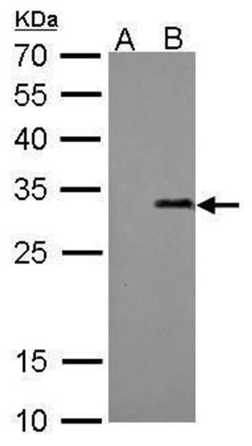 PIMA517283 | Invitrogen Antigen Strep Tag Host Species Mouse Ta