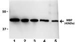 PIMA527544 | Ma527544 Mbp Antibody