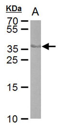 PIMA527870 | Invitrogen Antigen Cre recombinase Host Species Mo