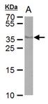 PIMA527870 | Invitrogen Antigen Cre recombinase Host Species Mo
