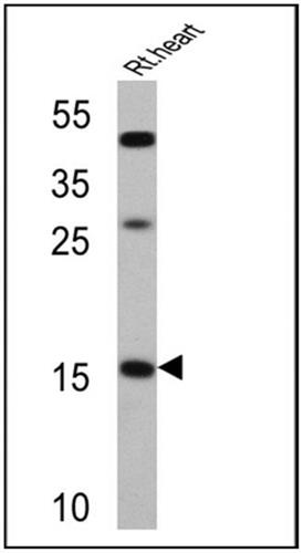 PIPA3228 | Invitrogen Antigen ANP Host Species Rabbit Target