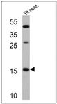 PIPA3228 | Atrial Natriuretic Peptide Ab